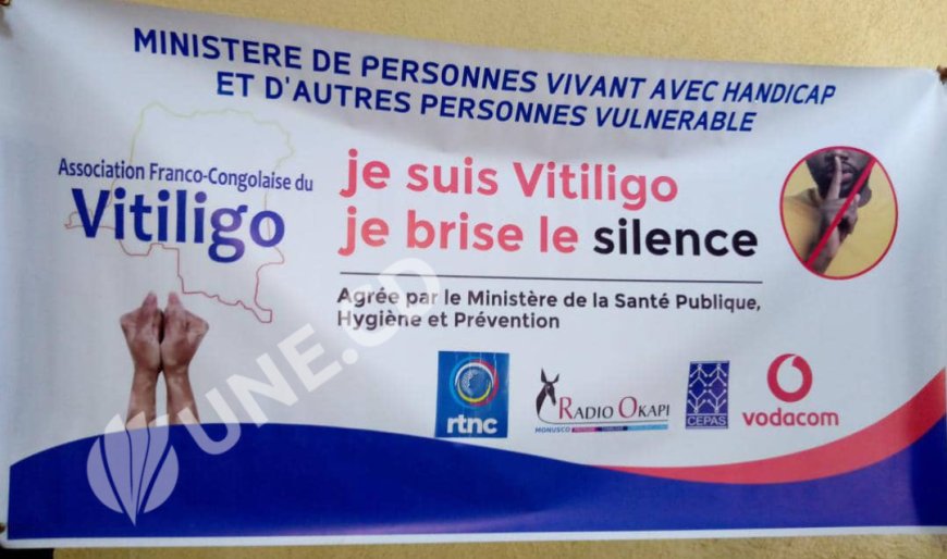 Huguette Kalenga, l'héroïne qui milite pour la reconnaissance de la maladie de peau «Vitiligo » en RDC 